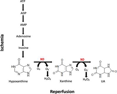 Salivary Xanthine Oxidase as a Potential Biomarker in Stroke Diagnostics
